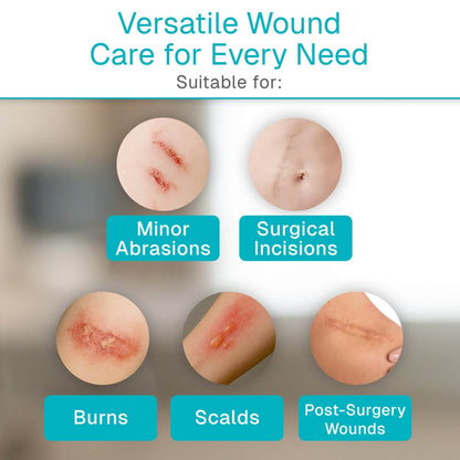 Gelling Fiber Wound Dressing